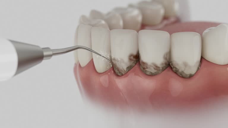 Reliable Dental Implants contractor in Adelanto, CA by Smile Center Dentistry